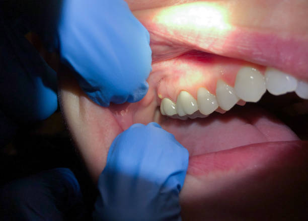 Best Knocked-Out Tooth Emergency  in Cadillac, MI